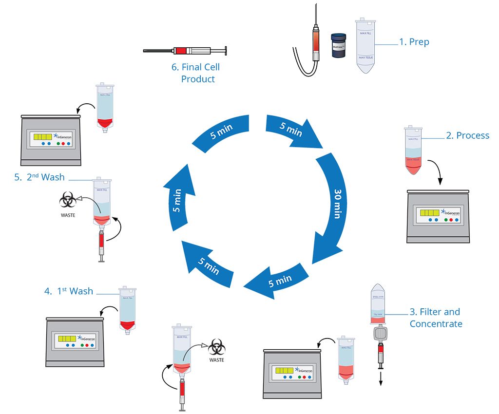 Diagram illustrating a six-step cell processing cycle, including preparation, washing, filtering, and final product stages.