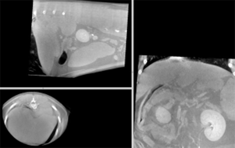 Three medical scan images showing internal organs, including kidneys, in different cross-sectional views.